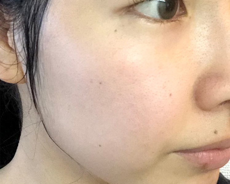 マトリックスエキス　お試し　navis 24日目